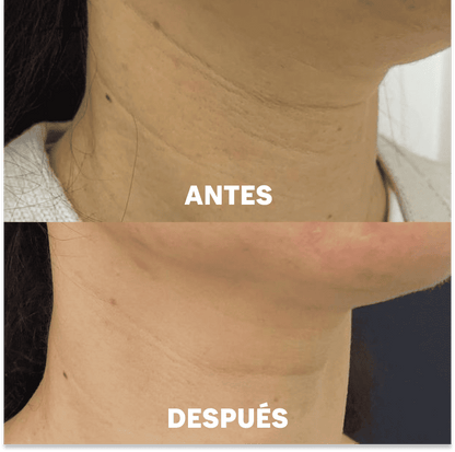 Mascarillas para el Cuello Aurealface™
