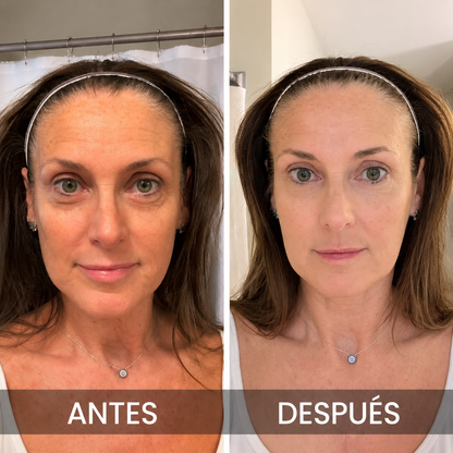 Bálsamo coreano para el contorno de ojos