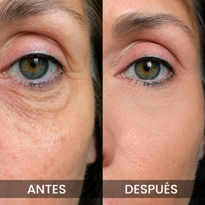 Bálsamo coreano para el contorno de ojos